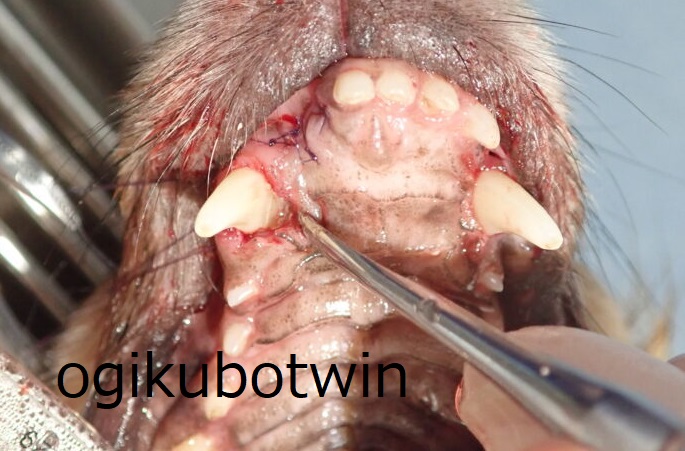 犬歯　再生治療　右